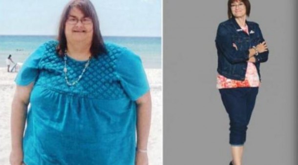 Clara Williams seorang ibu asal Amerika Serikat berhasil menurunkan berat badanya sebanyak 110 kilogram | Dailymail.com