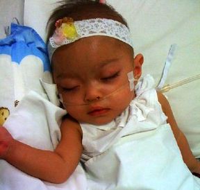 Pascaoperasi, Perjuangan Bayi Penderita Jantung Bocor Ini Belum Selesai