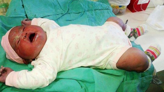 Bayi Perempuan Raksasa Lahir di Argentina