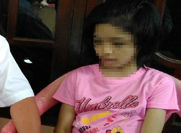 NR korban penganiayaan orang tua di Kemiling, Bandar Lampung | Andi/jejamo.com