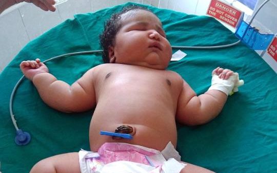 Lahir dengan Berat 6,8 Kilogram, Mungkinkan Ini Bayi Terbesar di Dunia?