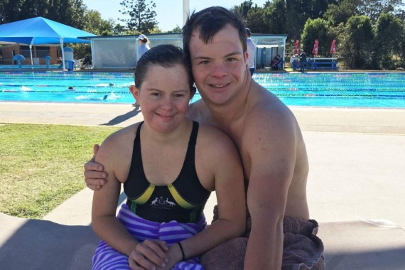Kisah Cinta Pasangan Penderita Down Syndrome yang Bikin Penasaran Netizen di Dunia