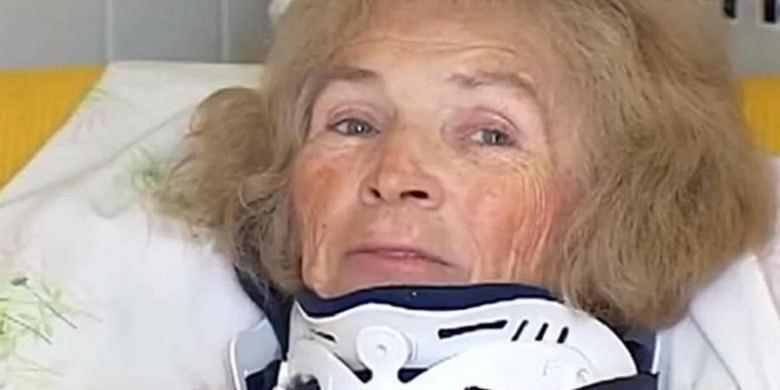 Mary Ann Franco, buta selama 23 tahun akhirnya bisa melihat setelah terjatuh di rumahnya. | Ist.