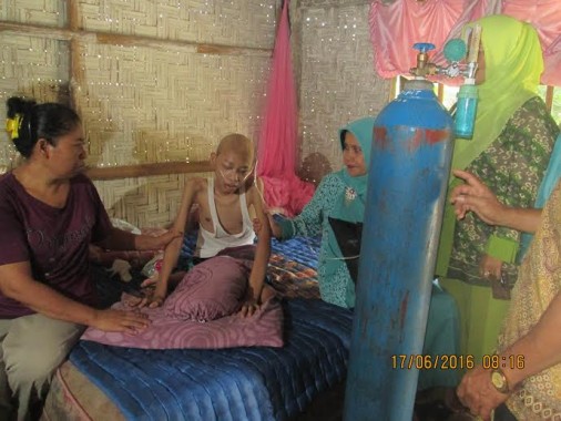 Derita Remaja Penderita Kanker Tulang dan Paru-paru dari Lampung Timur