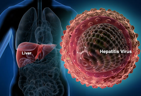 Hepatitis Jadi Virus Paling Mematikan di Dunia, Ini Gejalanya