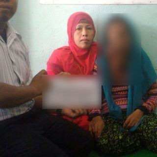 Sukmaenah warga Waymati, Desa Sukadanajaya, Lampung Timur, penderita tumor wajah | Suparman/jejamo.com
