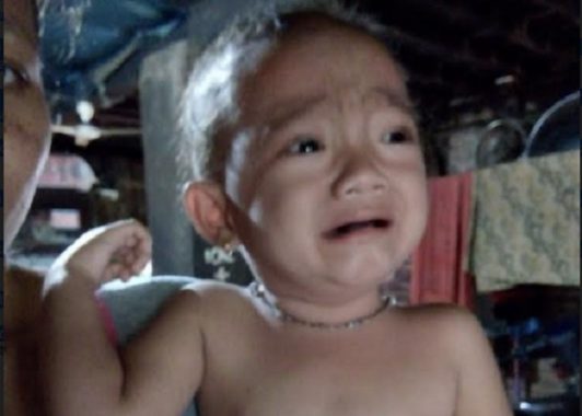 Pasien Gizi Buruk di Lampung Utara Sembuh Berkat Kejasama Puskesmas, Disdukcapil dan Rumah Sakit