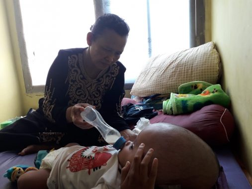 Bayi Hydrocephalus Asal Lampung Utara Ini Belum Ada Perubahan, Ibu dan Ayahnya Cari Dana Tambahan Berobat