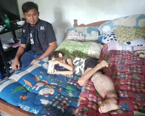 MSR-ACT Lampung Galang Donasi untuk Pengobatan Tumor Kaki Naufal