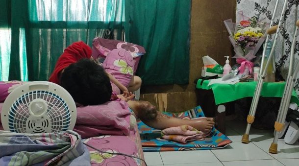 Kementerian Sosial RI Beri Bantuan Warga Penderita Kaki Bengkak di Tanggamus