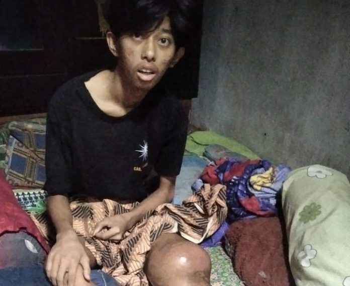 Dimas Kanker Tanggamus